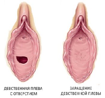 Голые письки девственниц крупным планом